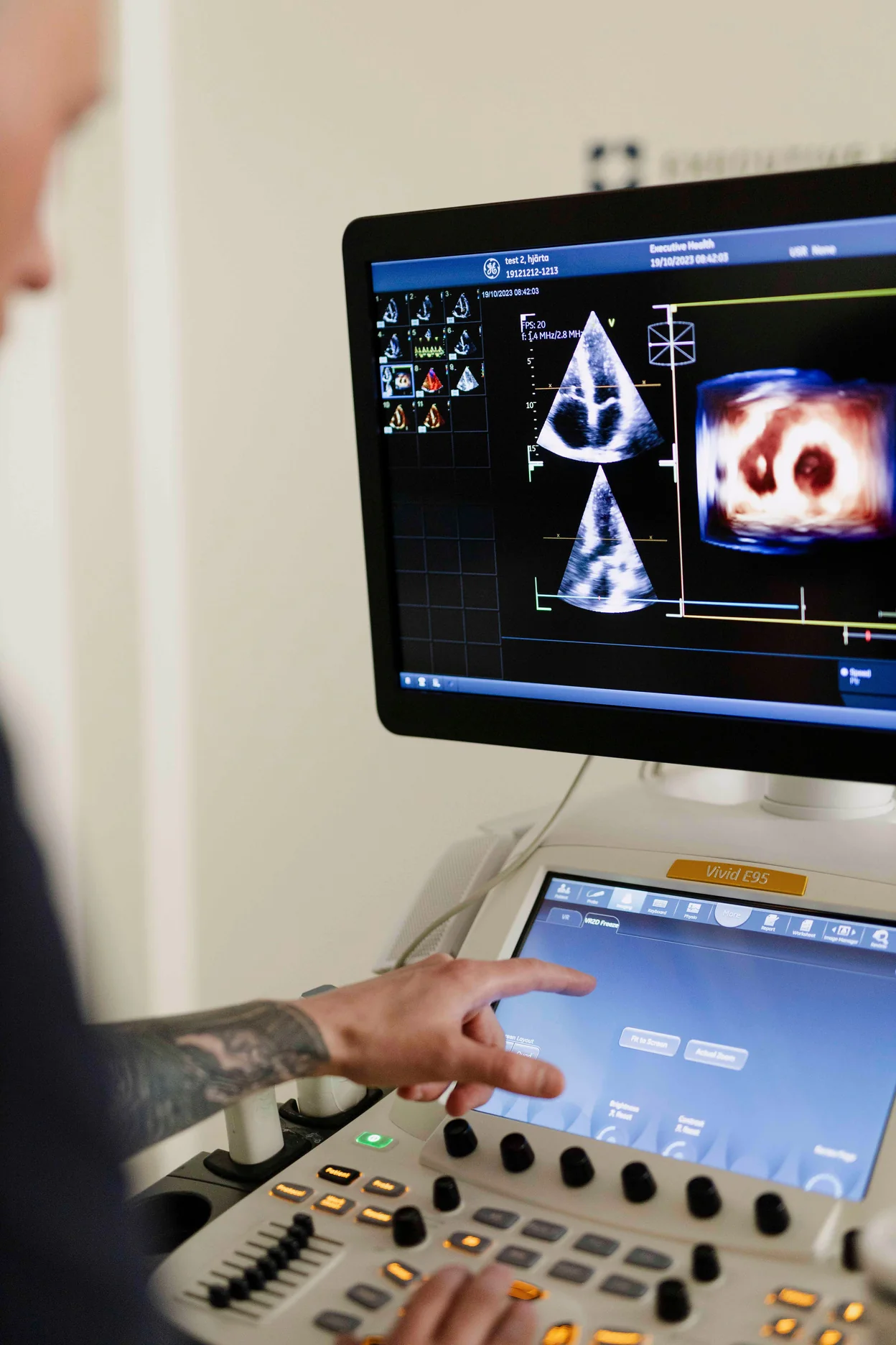 Ultrasound imaging equipment used during a gynecological examination at Executive Health.